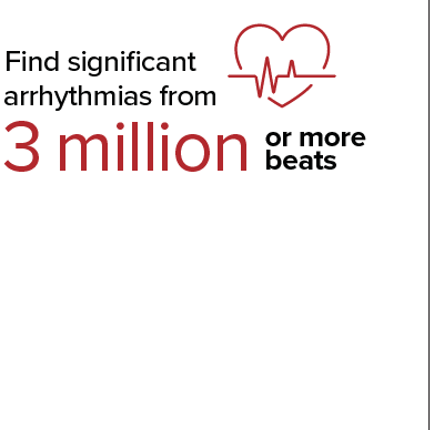 Find significant arrhythmias from 3 million beats